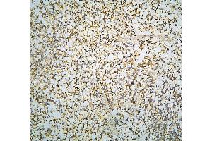 IHC analysis of R Cadherin/CDH4 using anti-R Cadherin/CDH4 antibody (ABIN6719392).