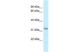 WB Suggested Anti-Hsd17b11 Antibody Titration: 1. (HSD17B11 Antikörper  (Middle Region))