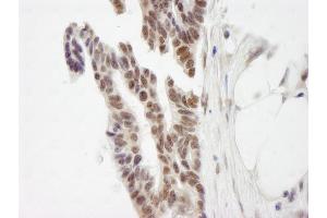 Immunohistochemistry (IHC) image for anti-Zinc Finger Protein 261 (ZMYM3) (AA 250-300) antibody (ABIN7448881)