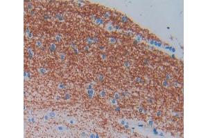 Used in DAB staining on fromalin fixed paraffin- embedded brain tissue (ELMO2 Antikörper  (AA 501-720))