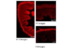 SLIT1 antibody used at a concentration of 2 and 10 ug/ml to detect gut tissue. (SLIT1 Antikörper)