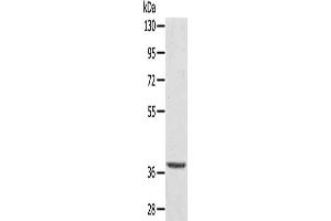 Gel: 8 % SDS-PAGE, Lysate: 40 μg, Lane: Hepg2 cells, Primary antibody: ABIN7192738(TBC1D21 Antibody) at dilution 1/300, Secondary antibody: Goat anti rabbit IgG at 1/8000 dilution, Exposure time: 10 seconds (TBC1D21 Antikörper)
