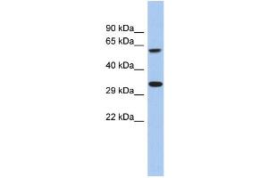 WB Suggested Anti-FAM26A Antibody Titration: 0. (CALHM3 Antikörper  (C-Term))