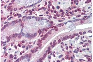 Human Small Intestine: Formalin-Fixed, Paraffin-Embedded (FFPE) (ABCC8 Antikörper  (N-Term))