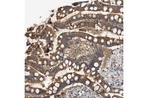 Immunohistochemical staining of human colon with WDR31 polyclonal antibody  strong cytoplasmic positivity in glandular cells at 1:200-1:500 dilution.