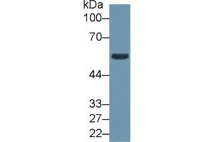 Detection of ALDH1B1 in Human HepG2 cell lysate using Polyclonal Antibody to Aldehyde Dehydrogenase 1 Family, Member B1 (ALDH1B1) (ALDH1B1 Antikörper  (AA 18-517))