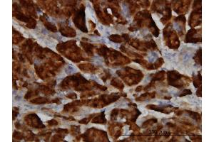 Immunoperoxidase of monoclonal antibody to SPINK1 on formalin-fixed paraffin-embedded human pancreas.