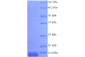 SDS-PAGE (SDS) image for Chemokine (C-C Motif) Ligand 7 (CCL7) (AA 28-97), (partial) protein (His tag) (ABIN5712654)