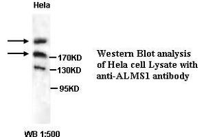 Image no. 1 for anti-Alstrom Syndrome 1 (ALMS1) antibody (ABIN1574631) (ALMS1 Antikörper)