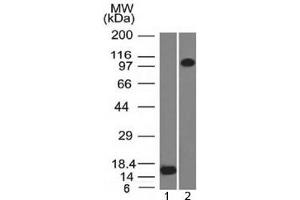 Western blot testing of 1) recombinant partial protein and 2) human ThP1 lysate with Thrombomodulin antibody (clone THBD/1591). (Thrombomodulin Antikörper  (AA 69-194))