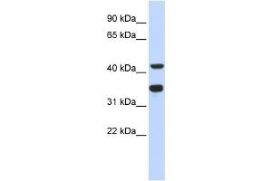 WB Suggested Anti-POLD2 Antibody Titration:  0. (POLD2 Antikörper  (N-Term))