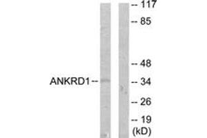 Western blot analysis of extracts from COLO205 cells, using ANKRD1 Antibody. (ANKRD1 Antikörper  (AA 231-280))