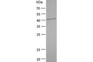 Western Blotting (WB) image for Interferon Regulatory Factor 3 (IRF3) (AA 2-427) protein (His tag) (ABIN7123496) (IRF3 Protein (AA 2-427) (His tag))