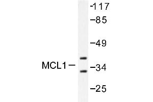 Image no. 1 for anti-Induced Myeloid Leukemia Cell Differentiation Protein Mcl-1 (MCL1) antibody (ABIN265513) (MCL-1 Antikörper)