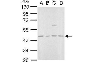 MVD anticorps  (Center)