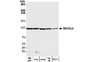 Western Blotting (WB) image for anti-Superkiller Viralicidic Activity 2-Like 2 (SKIV2L2) (AA 100-150) antibody (ABIN7449416) (MTR4 Antikörper  (AA 100-150))
