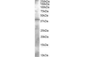 Image no. 1 for anti-Alcohol Dehydrogenase 1A (Class I), alpha Polypeptide (ADH1A) (N-Term) antibody (ABIN374506) (ADH1A Antikörper  (N-Term))