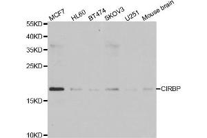 Western blot analysis of extracts of various cell lines, using CIRBP antibody. (CIRBP Antikörper)
