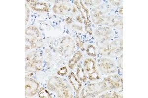 Immunohistochemistry of paraffin-embedded mouse kidney using UBQLN2 Rabbit pAb (ABIN6127815, ABIN6149859, ABIN6149860 and ABIN6225041) at dilution of 1:250 (40x lens). (Ubiquilin 2 Antikörper  (AA 1-150))