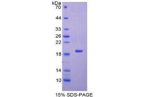 SDS-PAGE (SDS) image for Galectin 7 (LGALS7) (AA 2-136) protein (His tag) (ABIN2124914)