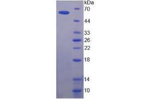 SDS-PAGE analysis of Human P-glycoprotein 1 Protein.