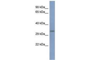 Image no. 1 for anti-Poly(rC) Binding Protein 3 (PCBP3) (AA 251-300) antibody (ABIN6743030) (PCBP3 Antikörper  (AA 251-300))