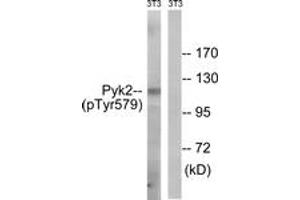 Western blot analysis of extracts from NIH-3T3 cells, using PYK2 (Phospho-Tyr579) Antibody. (PTK2B Antikörper  (pTyr579))