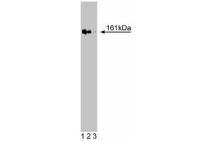 Western blot analysis of TopBP1 on a Jurkat cell lysate (Human T-cell leukemia, ATCC TIB-152). (TOPBP1 Antikörper  (AA 204-416))
