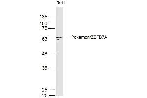 293T lysates probed with PokemonZBTB7A Polyclonal Antibody, Unconjugated  at 1:500 dilution and 4˚C overnight incubation. (ZBTB7A Antikörper  (AA 151-250))