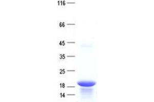 Western Blotting (WB) image for Host Cell Factor C1 Regulator 1 (XPO1 Dependent) (HCFC1R1) protein (His tag) (ABIN2722462)