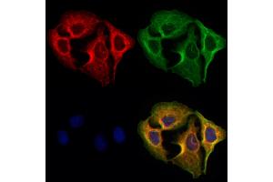 ABIN6265416 and ABIN6273079 staining Hela cells by IF/ICC.