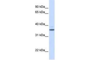 Image no. 1 for anti-Vitamin D-Binding Protein (GC) (AA 216-265) antibody (ABIN6744222)
