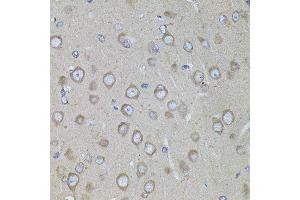 Immunohistochemistry of paraffin-embedded rat brain using CRHR1 antibody. (CRHR1 Antikörper  (AA 24-120))