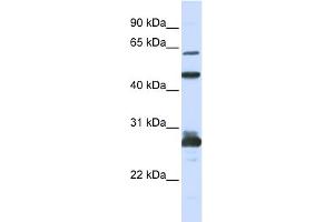 WB Suggested Anti-PES1 Antibody Titration: 0. (PES1 Antikörper  (C-Term))