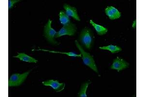 Immunofluorescence staining of U251 cells with ABIN7151510 at 1:133, counter-stained with DAPI. (ERC1 Antikörper  (AA 1-224))