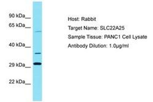 SLC22A25 antibody  (AA 271-320)