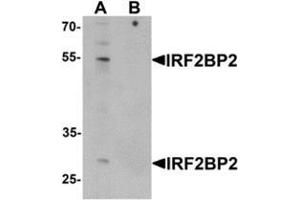 Western blot analysis of IRF2BP2 in HeLa cell lysate with IRF2BP2 Antibody  at 1 ug/mL in (A) the absence and (B) the presence of blocking peptide. (IRF2BP2 Antikörper  (C-Term))