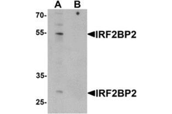 IRF2BP2 抗体  (C-Term)