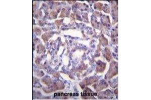 PRSS3 Antibody (Center) (ABIN655869 and ABIN2845275) immunohistochemistry analysis in formalin fixed and paraffin embedded human pancreas tissue followed by peroxidase conjugation of the secondary antibody and DAB staining.