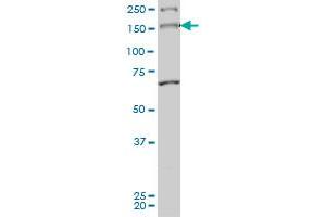 MYO3A monoclonal antibody (M01), clone 8D12 Western Blot analysis of MYO3A expression in Hela S3 NE . (MYO3A Antikörper  (AA 1400-1490))