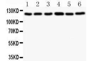 Observed bind size: 122KD (BUB1 Antikörper  (AA 731-1085))