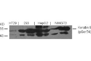 Image no. 2 for anti-Keratin 8 (KRT8) (pSer74) antibody (ABIN401539) (KRT8 Antikörper  (pSer74))