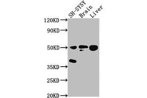 Western Blot Positive WB detected in: SH-SY5Y whole cell lysate, Rat brain tissue, Rat liver tissue All lanes: SEPT11 antibody at 1:2000 Secondary Goat polyclonal to rabbit IgG at 1/50000 dilution Predicted band size: 50, 51 kDa Observed band size: 50 kDa (Septin 11 Antikörper  (AA 237-429))