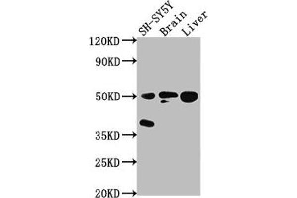 Septin 11 anticorps  (AA 237-429)