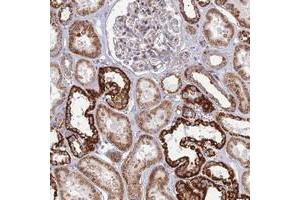 Immunohistochemical staining of human kidney with SLC35F4 polyclonal antibody  shows strong cytoplasmic positivity in cells in tubules at 1:200-1:500 dilution. (SLC35F4 Antikörper)