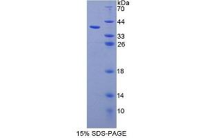 SDS-PAGE analysis of Human UBAP1 Protein. (UBAP1 Protein)