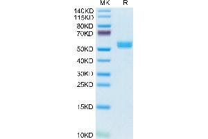 Biotinylated Cynomolgus BAFF Trimer on Tris-Bis PAGE under reduced condition. (BAFF Protein (Trimer) (His-Avi Tag,DYKDDDDK Tag,Biotin))