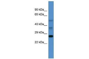 Western Blot showing Commd2 antibody used at a concentration of 1-2 ug/ml to detect its target protein. (COMMD2 Antikörper  (Middle Region))