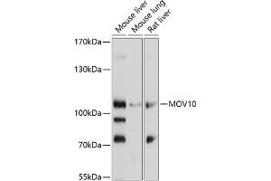 Western blot analysis of extracts of various cell lines, using MOV10 antibody (ABIN1680885, ABIN3018353, ABIN3018354 and ABIN6220441) at 1:1000 dilution. (MOV10 Antikörper  (AA 1-310))