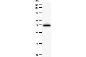 Western Blotting (WB) image for anti-Protein Phosphatase 1, Regulatory Subunit 13 Like (PPP1R13L) antibody (ABIN931102) (PPP1R13L Antikörper)